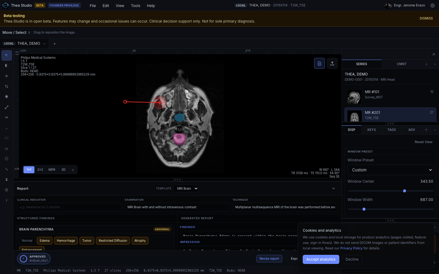 Thea Studio DICOM viewer with a sample MRI study and report workspace